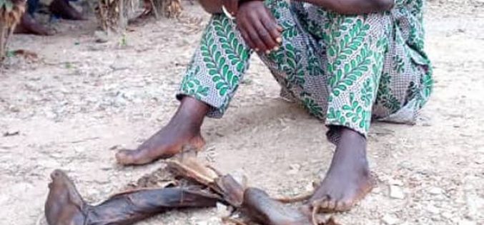 Police parade man caught with human parts in Osun