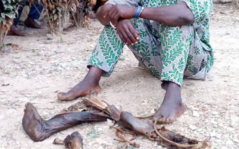 Police parade man caught with human parts in Osun