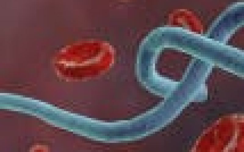 Fog delays delivery of Ebola vaccines for Guinea