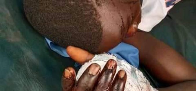 Herder attacks 58-yr-old man, son over missing cow in Bayelsa
