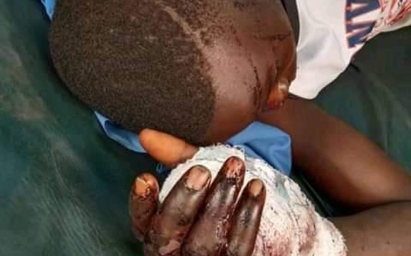 Herder attacks 58-yr-old man, son over missing cow in Bayelsa