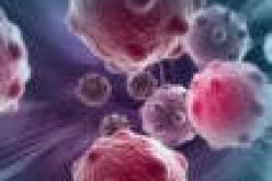 Over 80% of childhood cancers are curable — Expert