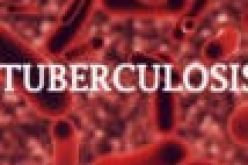 Tuberculosis kills 18 persons per hour in Nigeria ― Report