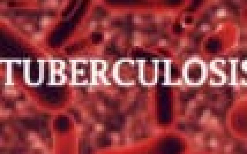 Tuberculosis kills 18 persons per hour in Nigeria ― Report