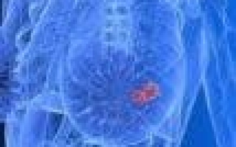 Sexuality: Why young girls have saggy breast