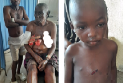 Survivors relive ordeal after armed militias wreak havoc in Benue IDPs camp, kill 7, injure many