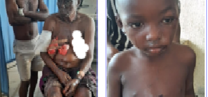 Survivors relive ordeal after armed militias wreak havoc in Benue IDPs camp, kill 7, injure many