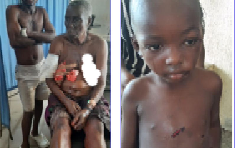 Survivors relive ordeal after armed militias wreak havoc in Benue IDPs camp, kill 7, injure many