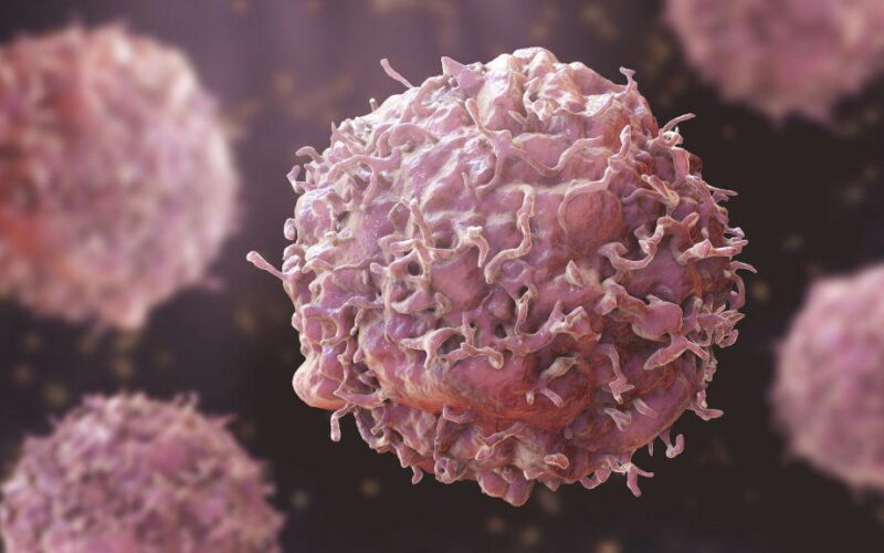 Cancer cases set to rise 67% by 2050 — GLOBOCAN