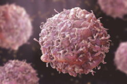 Early cancer diagnosis improves chances of effective treatment, outcome – FG