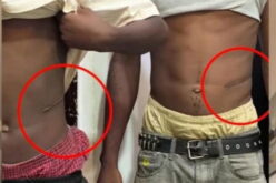 N1.5m for kidney: Lawyer alleges illegal organ harvest in Abuja