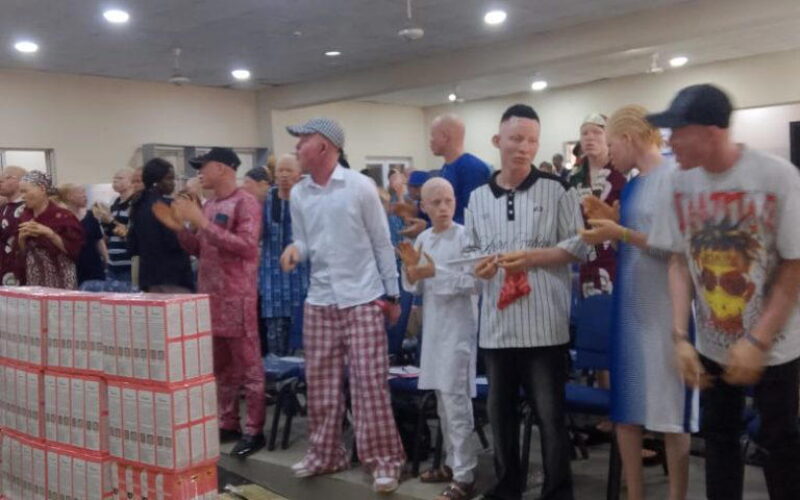 Aiyedatiwa assures persons with albinism of equal opportunities