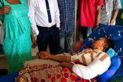 Hot water attack: University student hospitalised with severe burns in Benue