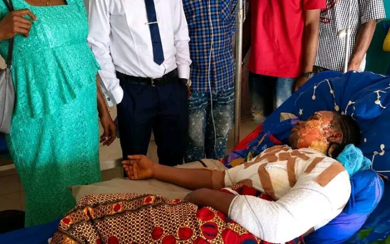 Hot water attack: University student hospitalised with severe burns in Benue