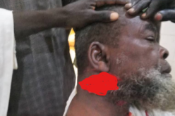 Lukuwa appeals for calm after knife attack