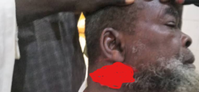 Lukuwa appeals for calm after knife attack