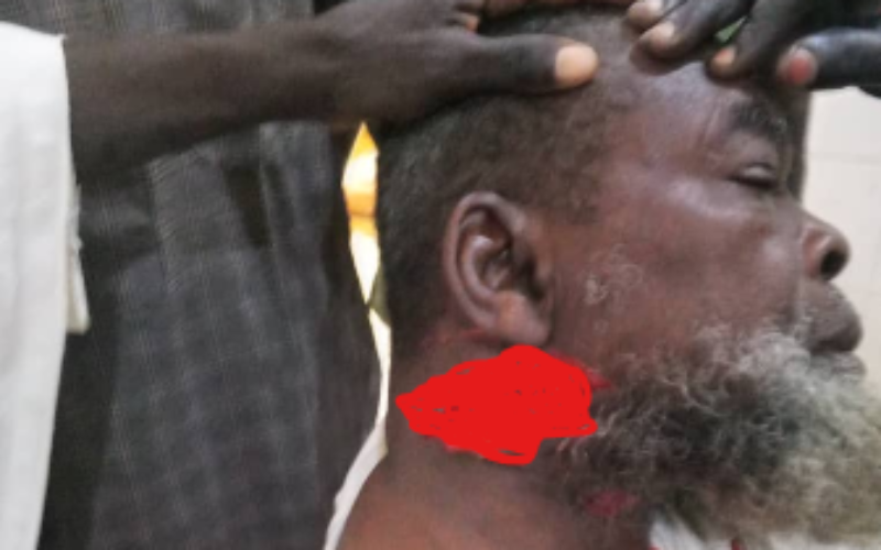 Lukuwa appeals for calm after knife attack