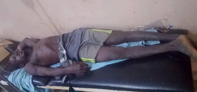 Sokoto attack : Beggar’s son shot by terrorist needs N190,000 for scan