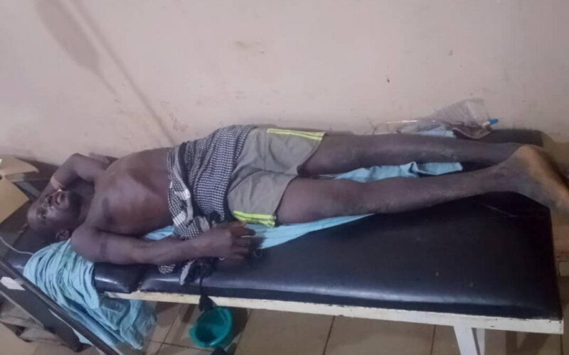 Sokoto attack : Beggar’s son shot by terrorist needs N190,000 for scan