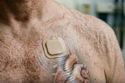Heartbeat by sound: Scientists develop non-invasive pacemaker